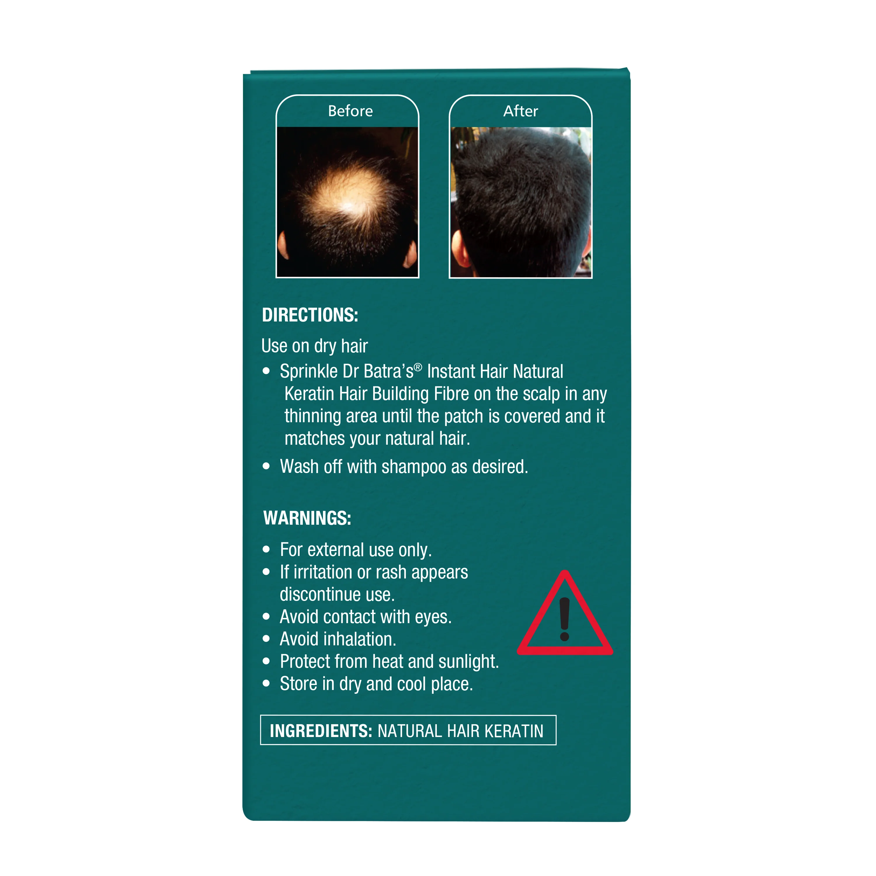 Instant Hair Natural keratin Hair Building Fibre - Black - Image 5